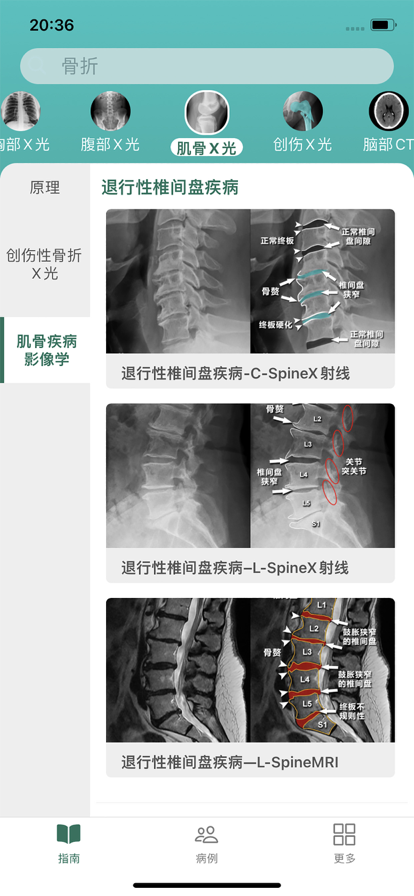 影像诊断指南app最新版下载_影像诊断指南手机版下载安装v1.0 安卓版 运行截图1