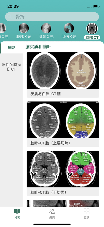 影像诊断指南app最新版下载_影像诊断指南手机版下载安装v1.0 安卓版 运行截图3