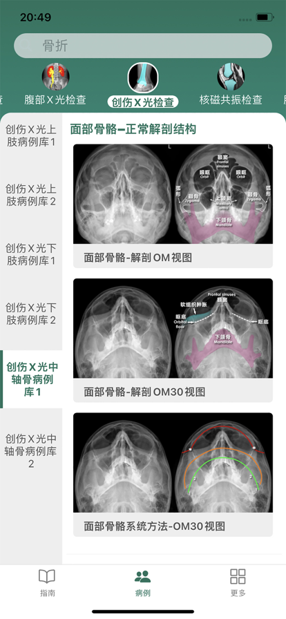 影像诊断指南