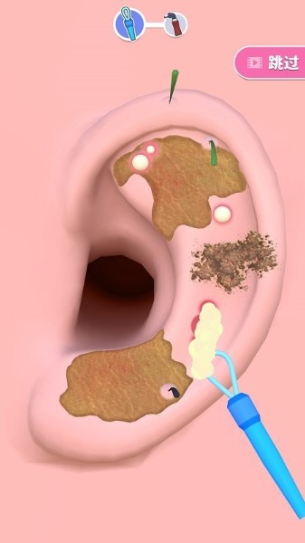 掏耳朵游戏下载-掏耳朵游戏官方手机版下载v2.3.1安卓版 运行截图2