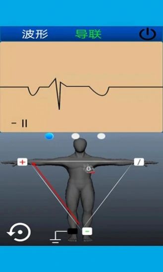 心电图计算器app下载_心电图计算器安卓版下载v1.1.0 安卓版 运行截图1