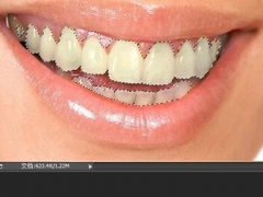 PS怎么让牙齿变白 PS牙齿美白详细教程