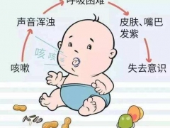 2020年春节一定不能给3岁以下宝宝吃哪些 防止宝宝噎到快学学海姆立克急救法