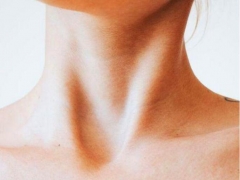 颈部皮肤如何快速护理 最容易被忽略的皮肤保养秘方