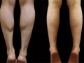 女生肚子胖怎么减肥 大象腿快速变大长腿的技巧分享