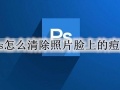 ps怎么清除照片脸上的痘痘 ps祛痘图文步骤详细教程