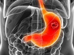 胃病怎么检查 胃病有哪些治疗方法